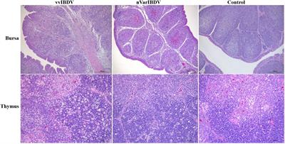Advances on adaptive immune responses affected by infectious bursal disease virus in chicken